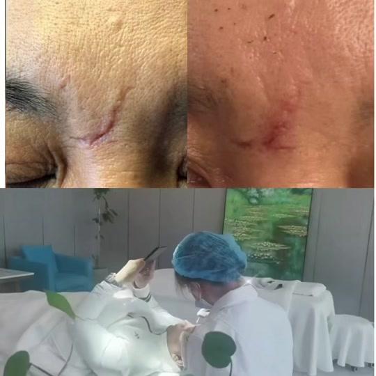 超级玩家艾伦