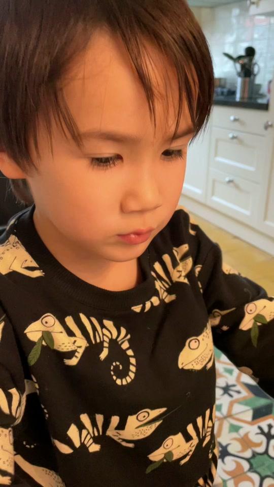 中荷混血双胞胎